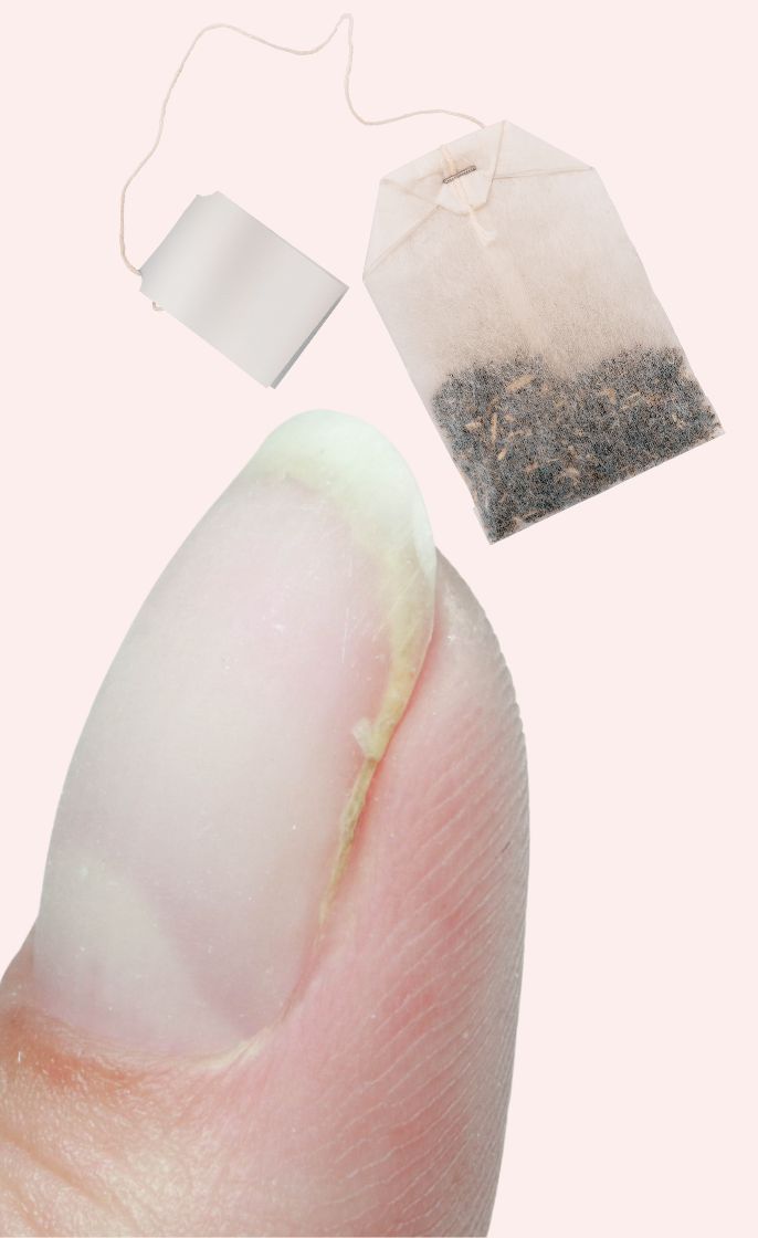 How to Fix a Broken Nail: We Show You How in 5 Ways!