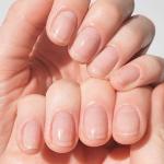 Cuticles With Dry Hand Nail Oil