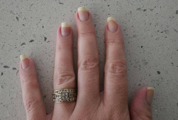 Gel Nail Polish Recovered Nails